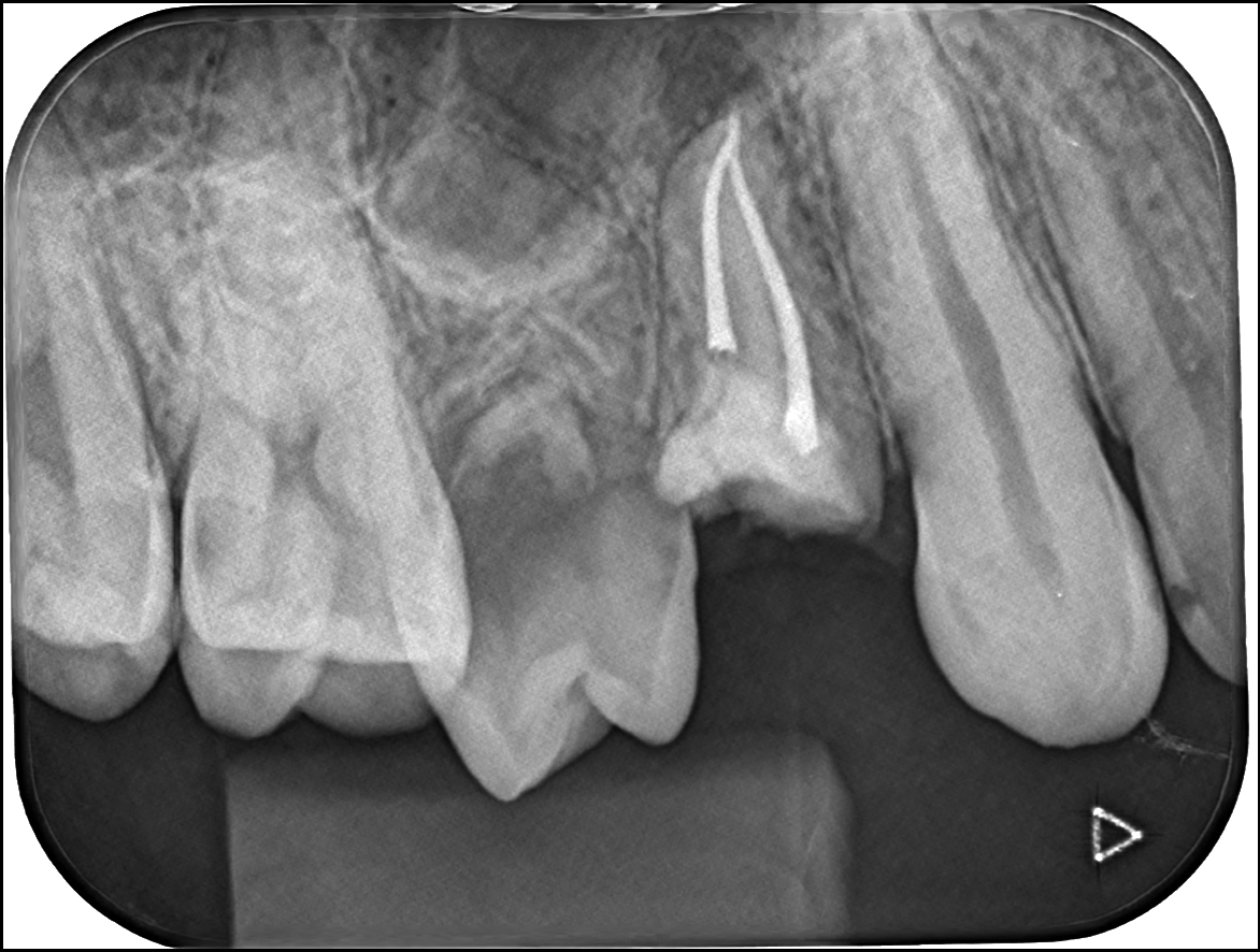 toothpreservation1