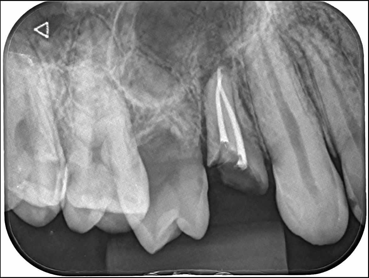 toothpreservation2