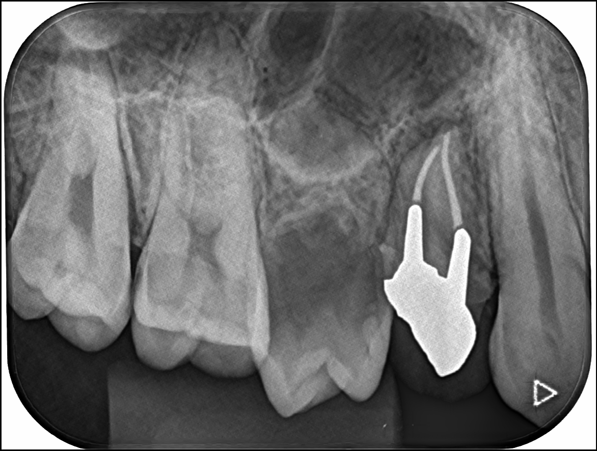 toothpreservation3